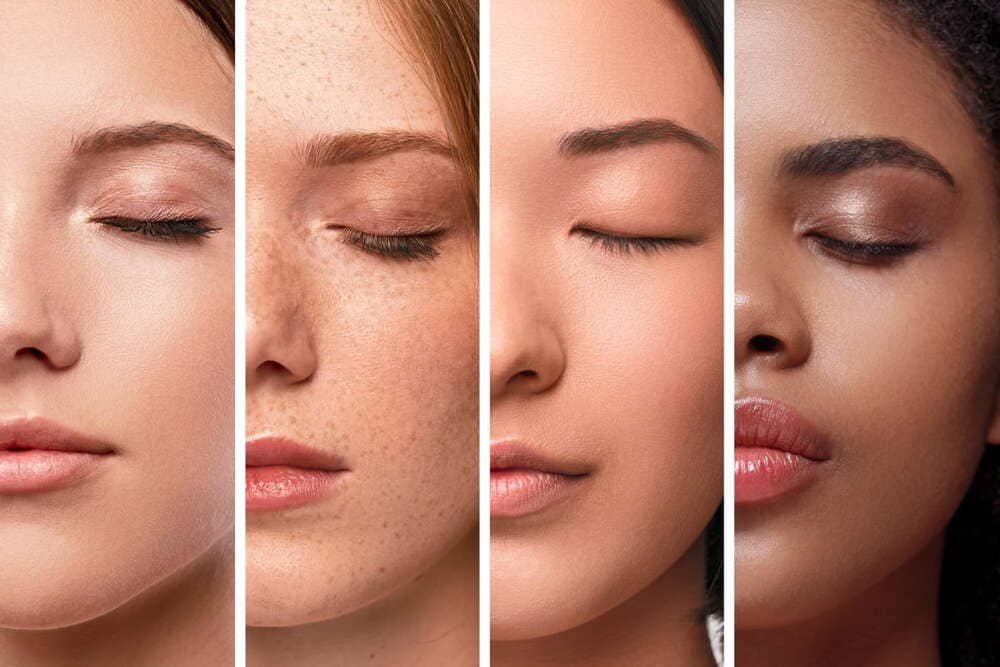 different-skin-types