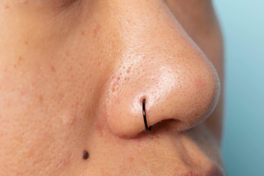 Effective-Modes-to-Avoid-Blackheads