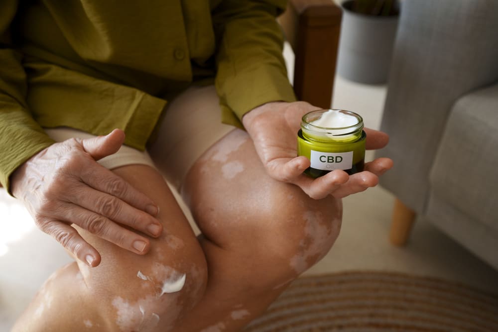 woman-using-skin-cream